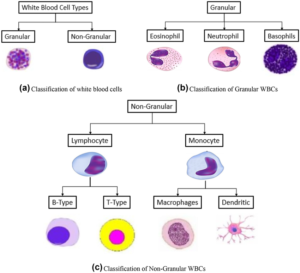 Detection and classification of leukocytes in leukemia using YOLO and ...